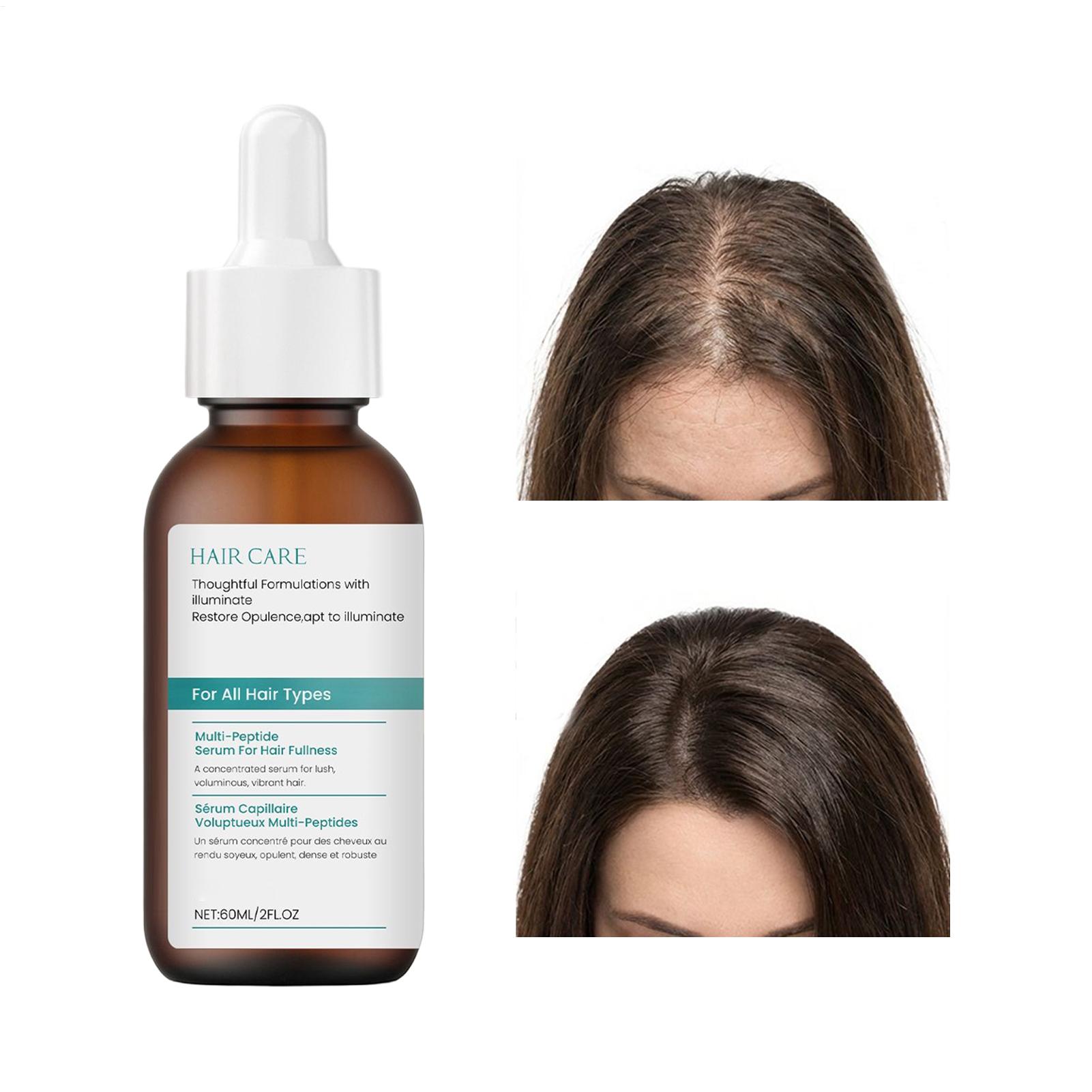 Líquido para alisar el cabello - Root Stimulator Liquid reseña y precio